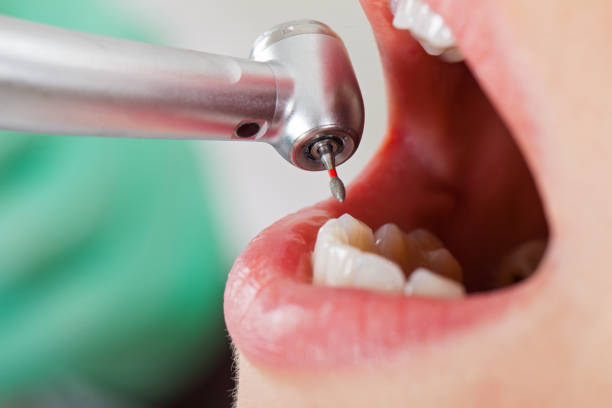 Best Emergency Dental Surgery in St Jaco, IL